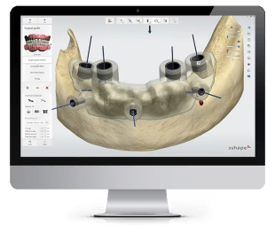 surgical guide 2